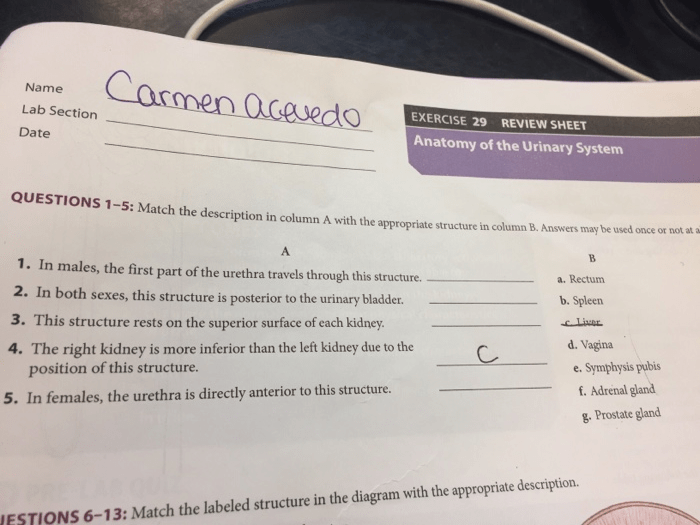 Exercise 29 review sheet anatomy of the urinary system